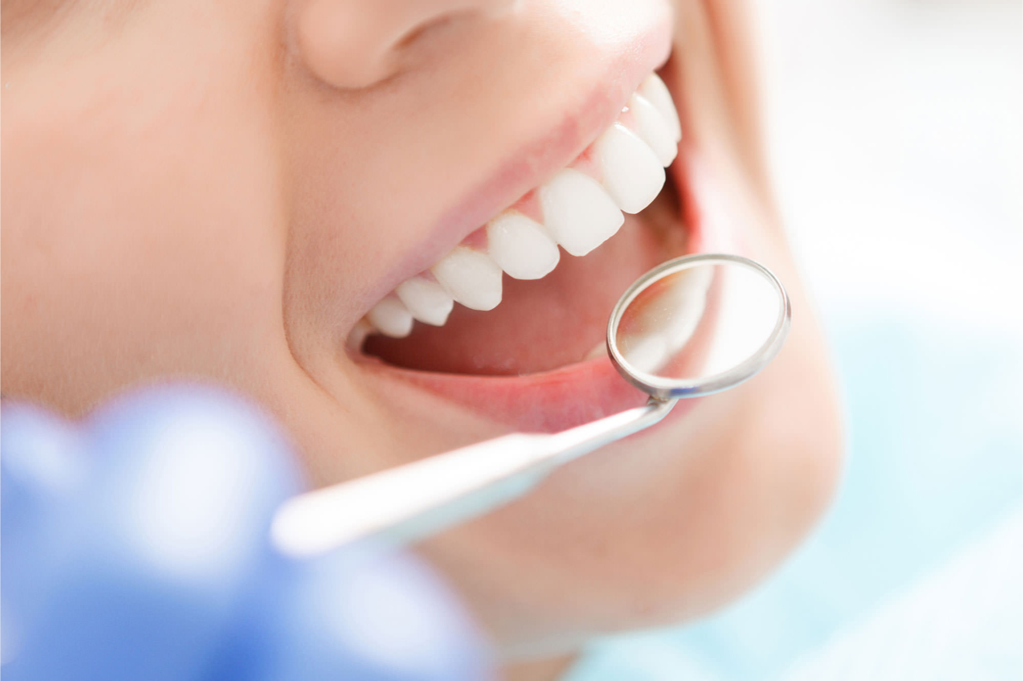 What Should You Know About The Dental Bridges?